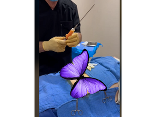 Tissue Extraction