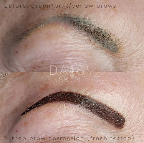 Brow Cosmetic Tattoo Coverup
