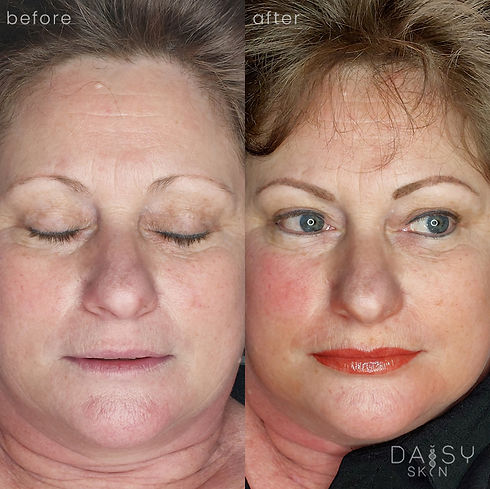 before after brow tattoo