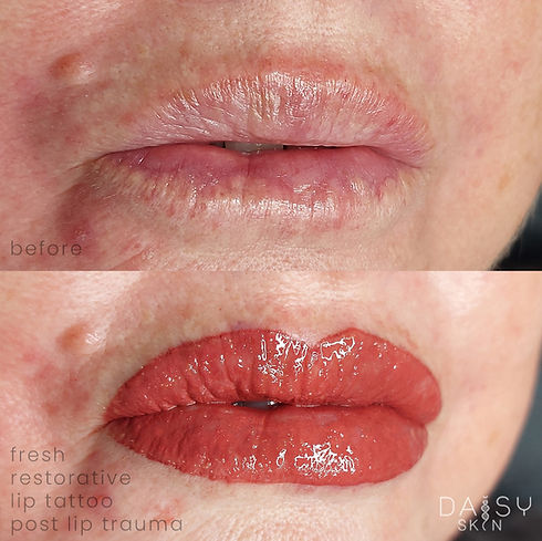 janine lips trauma fresh.jpg