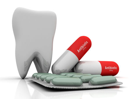 What are Antibiotics, and How do They Work in Treating Tooth Infections?