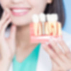 a woman holding a model of a dental implant