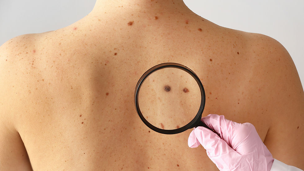 Skin Cancer Awareness: A Conversation Worth Having