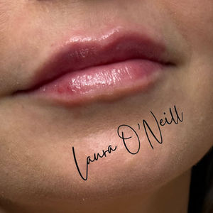 Lip Treatment Comparison