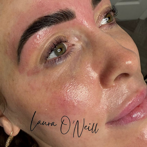 Radiant Skin After Treatment