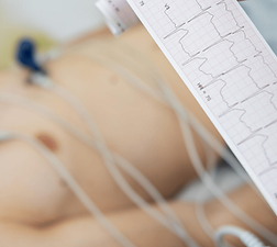 Evde EKG (1500 x 1000 px).png