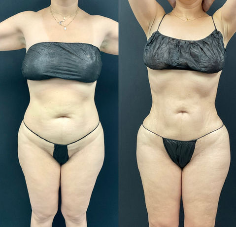 Face and body treatments | Aliestetic 