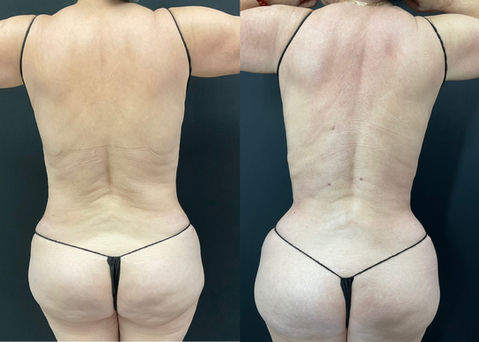 Face and body treatments | Aliestetic 