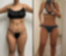 Plastic Surgery | Aliestetic