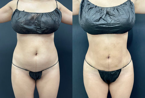 Face and body treatments | Aliestetic 