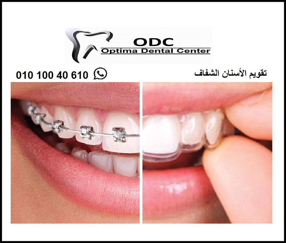 دكتور تقويم الاسنان فى امبابة