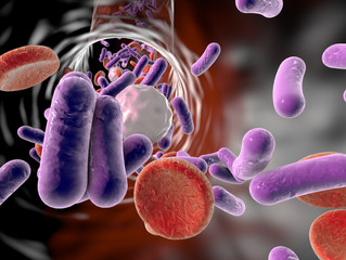 Is sepsis a factor?