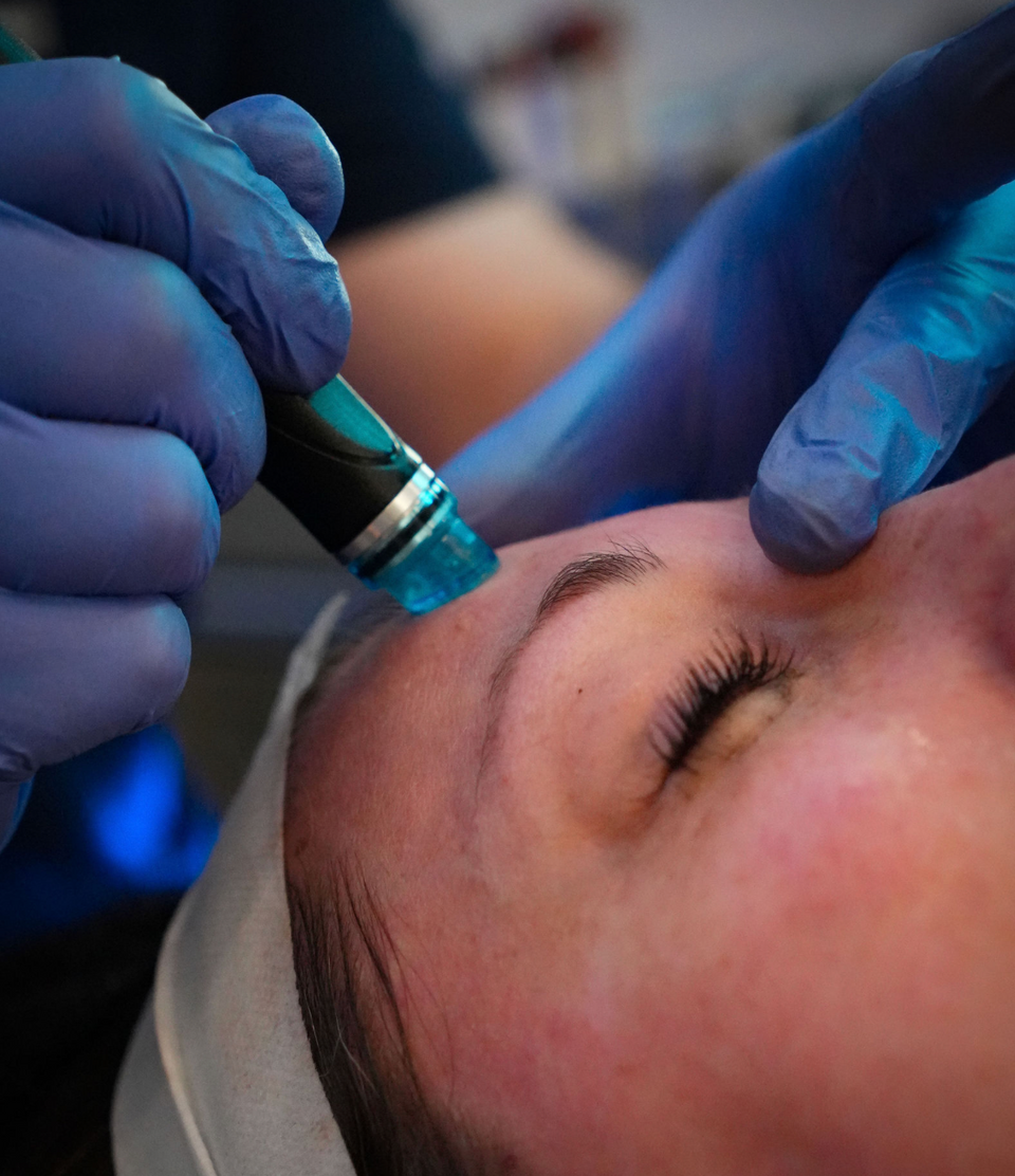 Hydrafacial