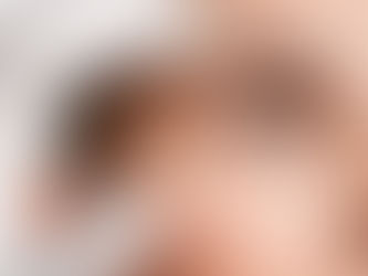 DAXXIFY vs. Xeomin vs. Jeuveau