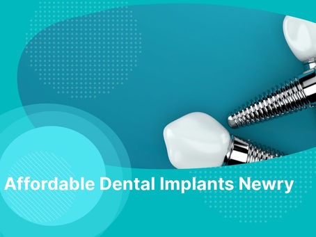 Affordable Dental Implants Newry