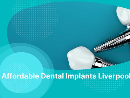 Affordable Dental Implants Liverpool