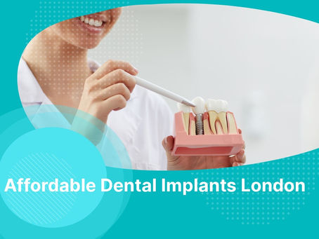 Affordable Dental Implants London