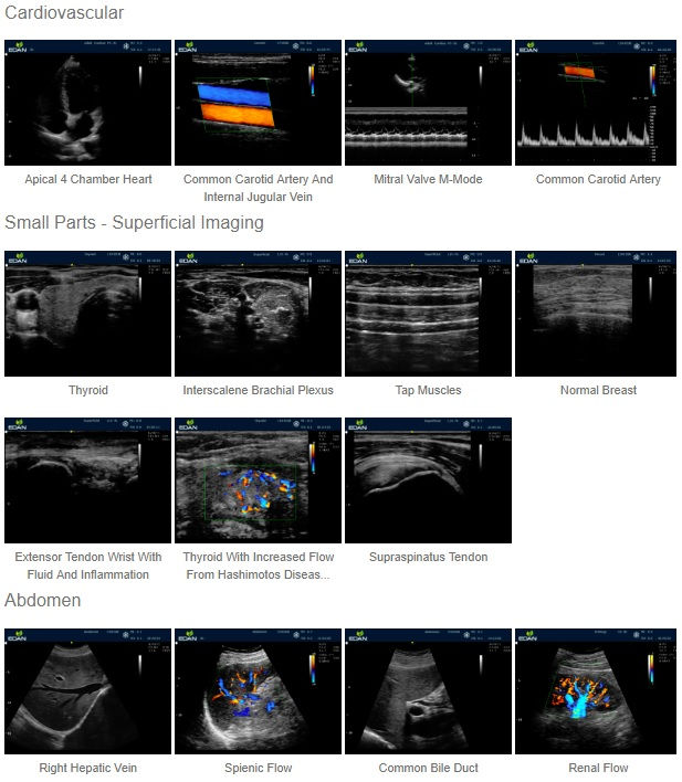 Миниатюра: Edan U60 Diagnostic Ultrasound System