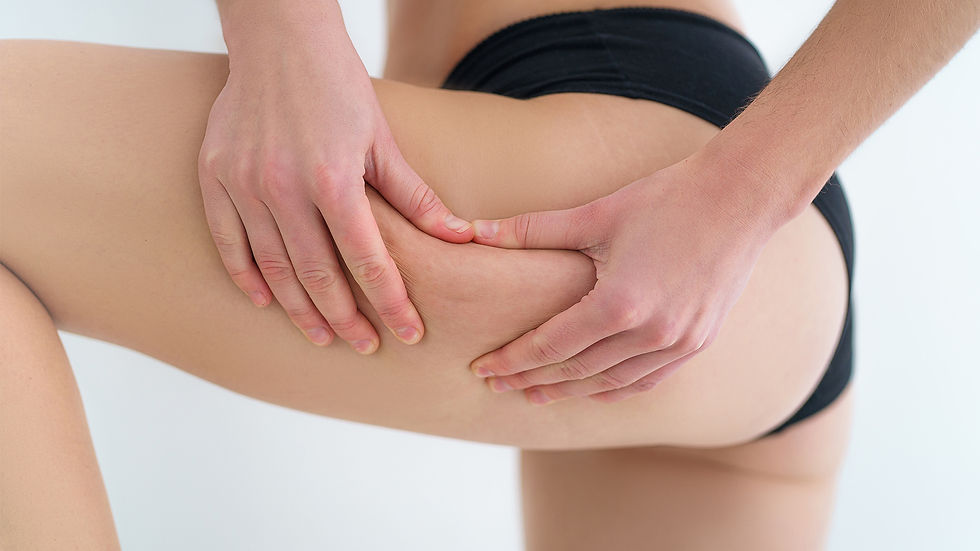 Trattamenti corpo cellulite - centri Fisico Thiene Trissino Vicenza Bassano