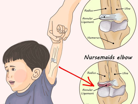 Hindari Nursemaid's Elbow Saat Mengajari Anak Berjalan, Apa Itu?  