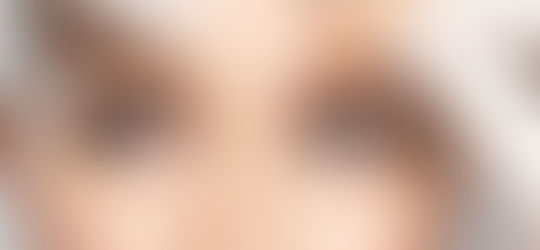 5 Myths About Botox That Just Aren’t True