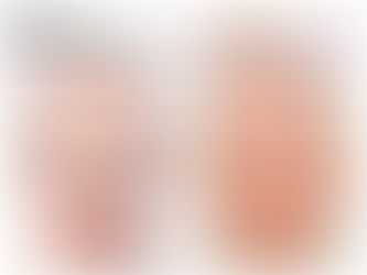 Você retira corretamente a maquiagem todos os dias?