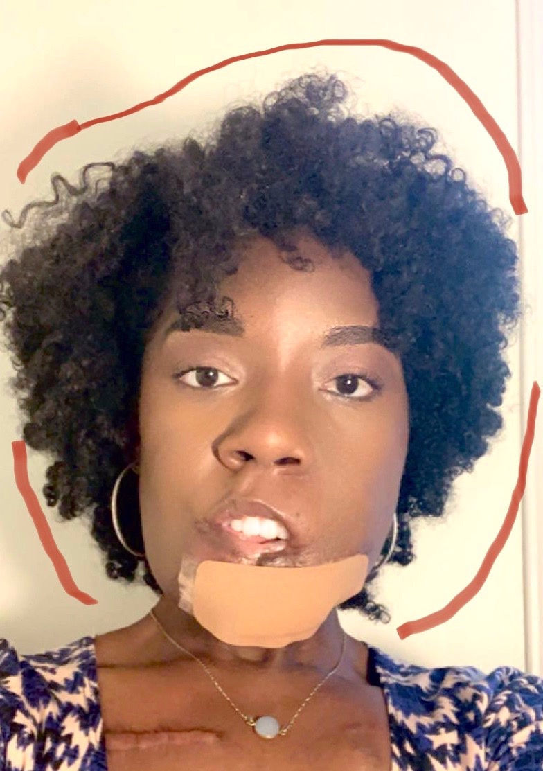 Face Equality Day 2020:              Exposed and Unmasked