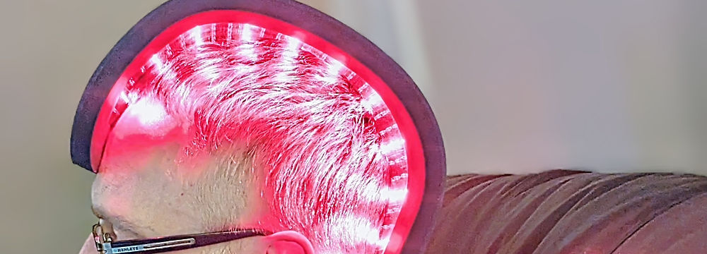 Blonde hair in a graduated bob cut.