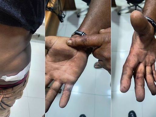 Mulher tenta matar o marido com facada na barriga em casa, em Nortelândia/MT