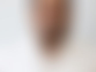 Helping Baby Boomers Take Care of Their Joints