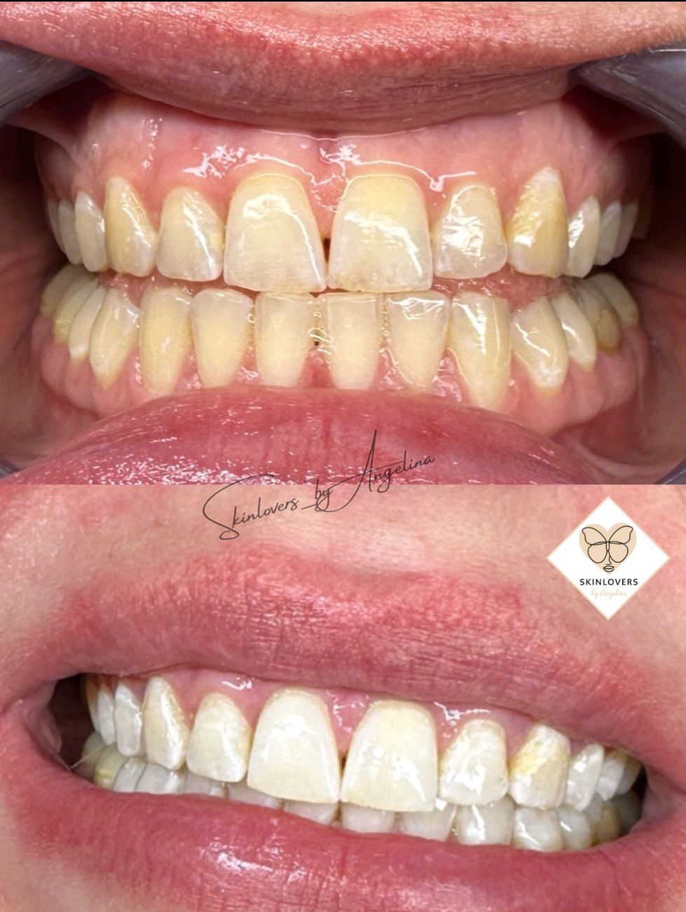 Bild-6 (1)_edited.jpg