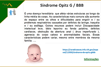 INFO - Síndrome Opitz G  BBB.png