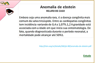 ESTUDO - Anomalia de Ebstein.png