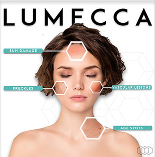 lumecca-ipl-treatments.jpg