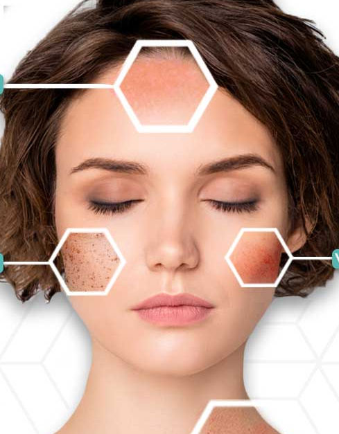 lumecca-ipl-treatments.jpg