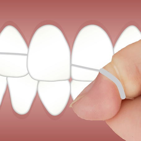 Flossing