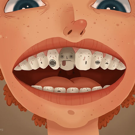 What is Tooth Decay?