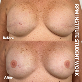 3D Areola Work by Student: RPM Institute