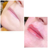 before and after lip blush