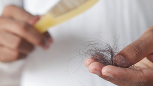 Early Signs of Thinning Hair You Should Not Ignore