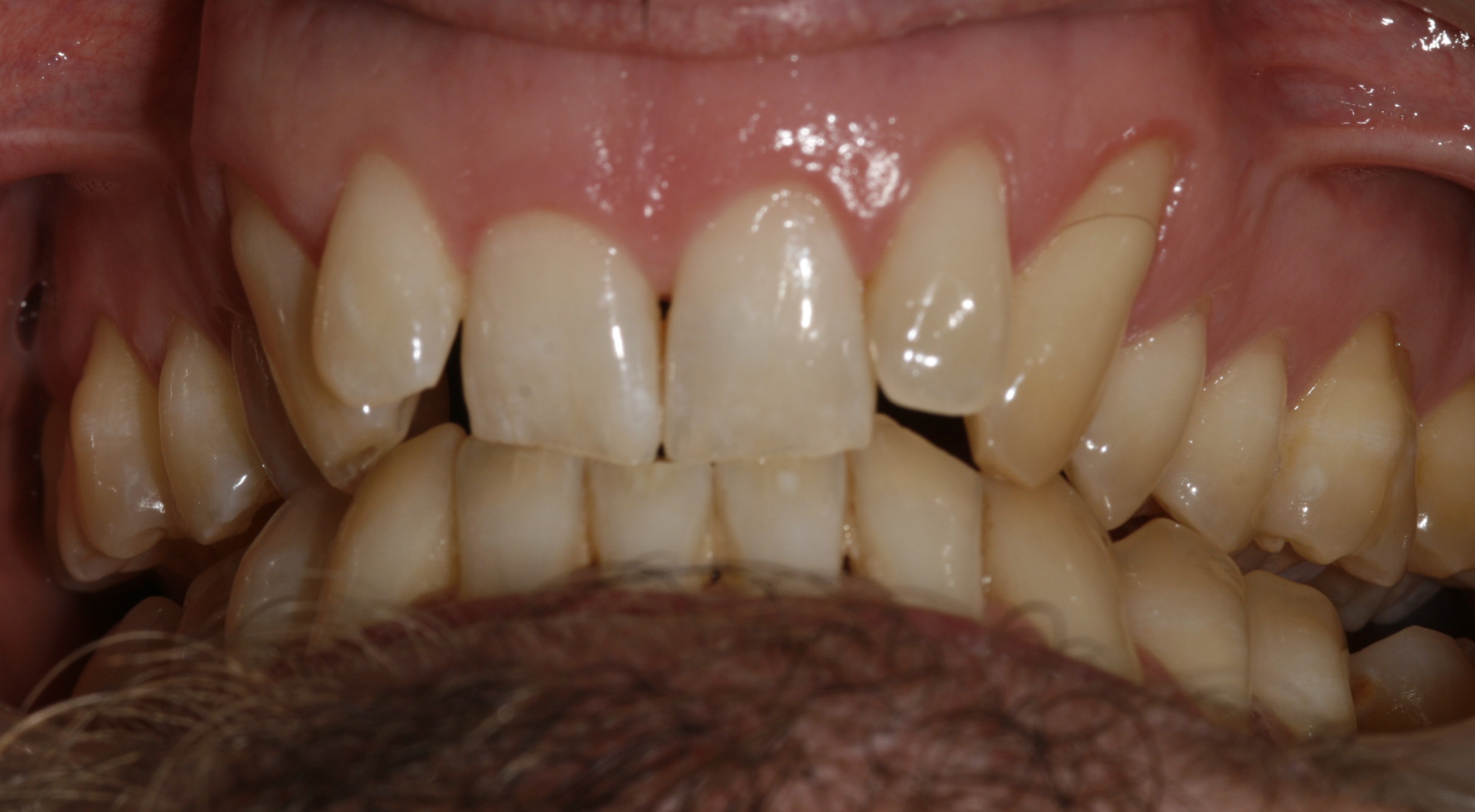 Life changing treatment @Broad Street Dental