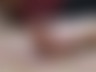 Prescription Opioid Addiction