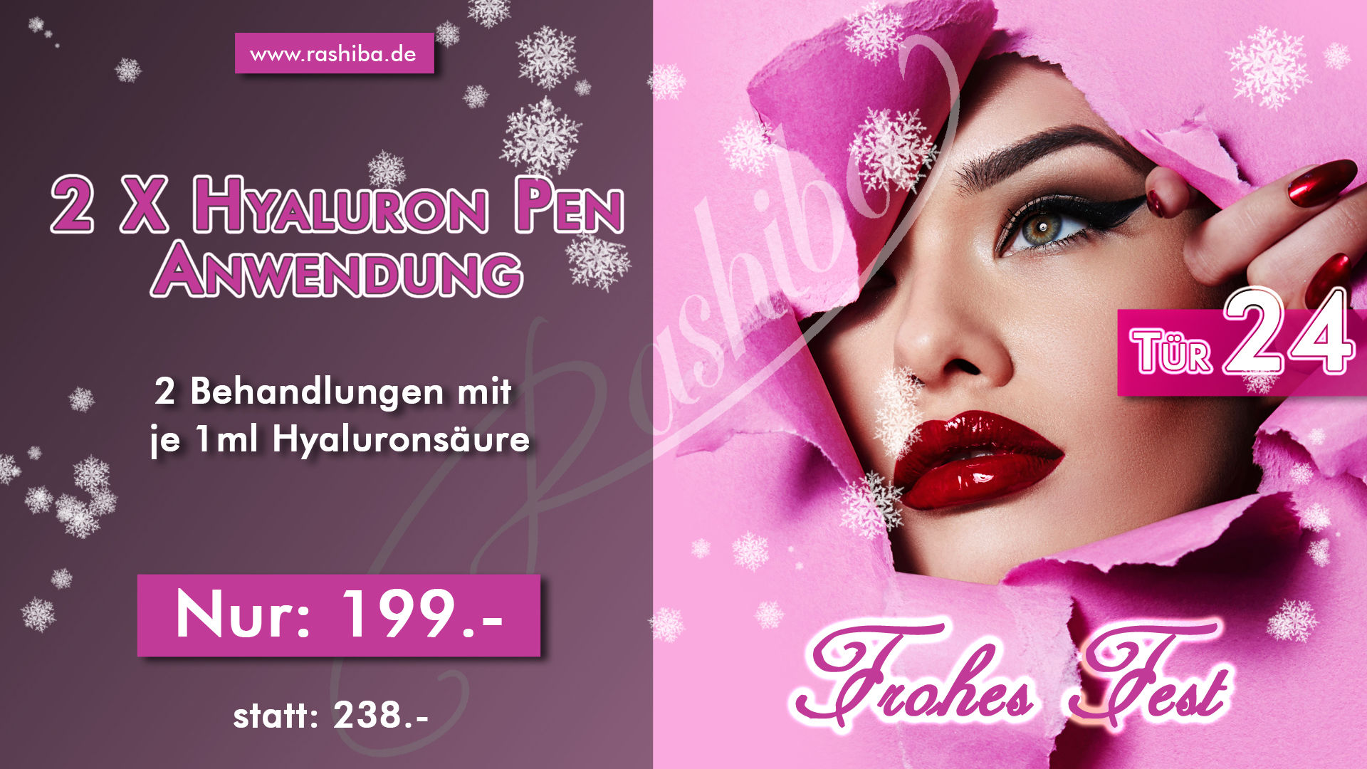 2 x Hyaluron Pen Behandlung (a 1ml Hyaluronsäure)