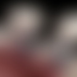 Імплантація зубів? Процес імплантації зубів?