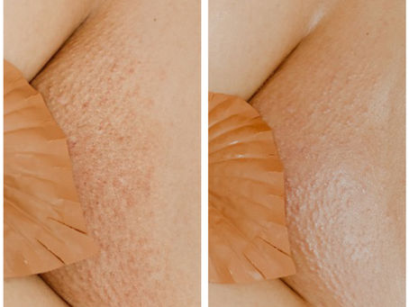 The Complete Guide to Brazilian Waxing: History, Benefits, and What to Expect