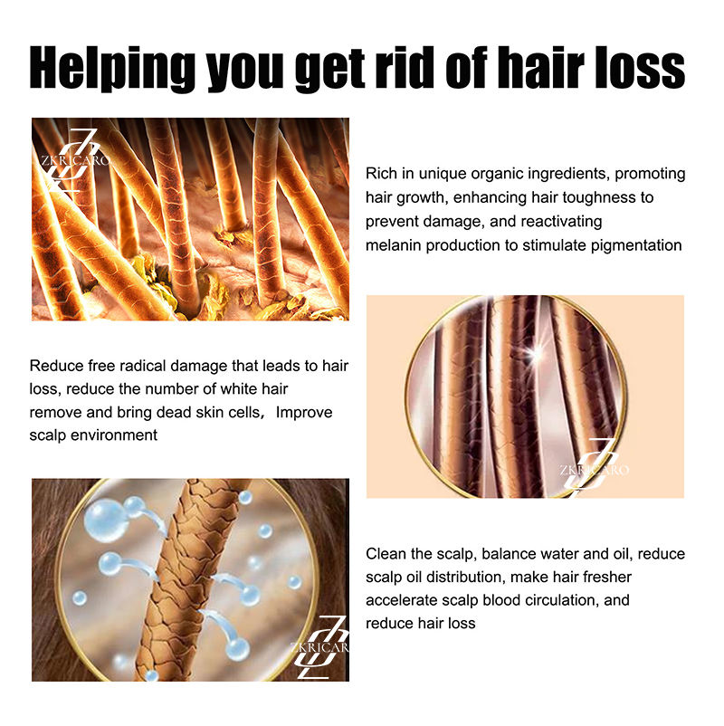 Thumbnail: Promote hair root growth and give you beautiful hair