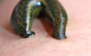 Hirudothérapie : les bienfaits thérapeutiques des sangsues. Les applications de l’hirudothérapie