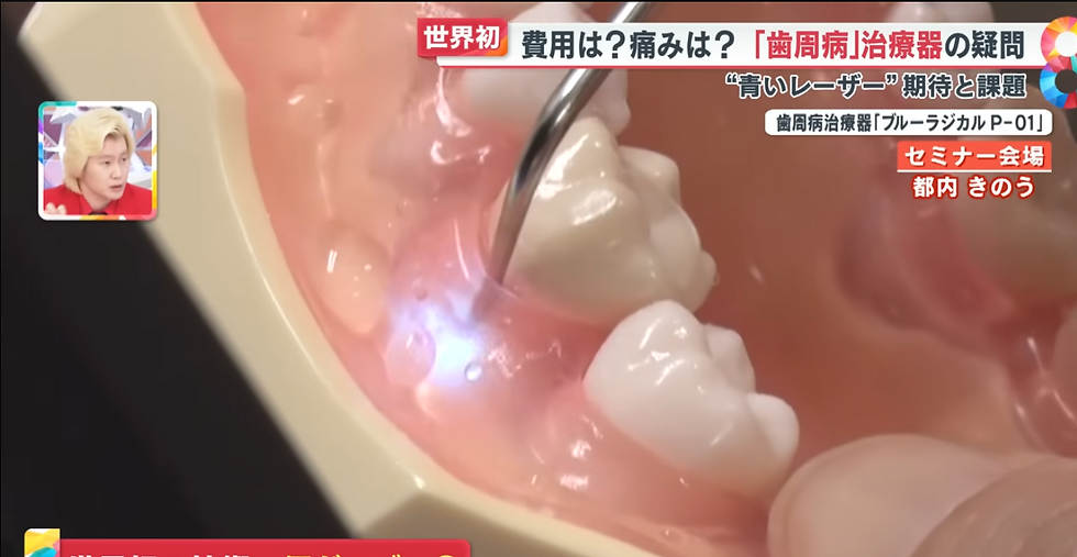 4/15(火)21時 KKTテレビ「カズレーサーと学ぶ」で当院導入済み歯周病治療器のブルーラジカルが紹介されます！