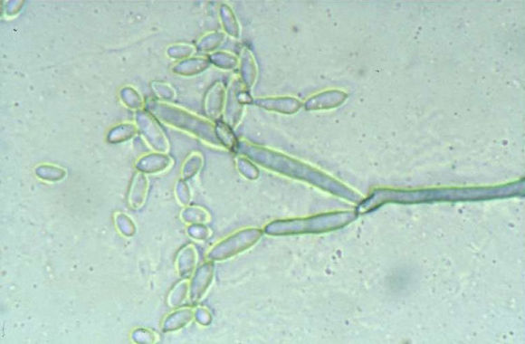 Cladosporium herbarum