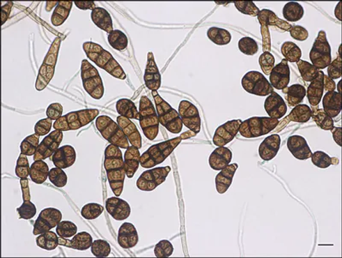 Alternaria alternata